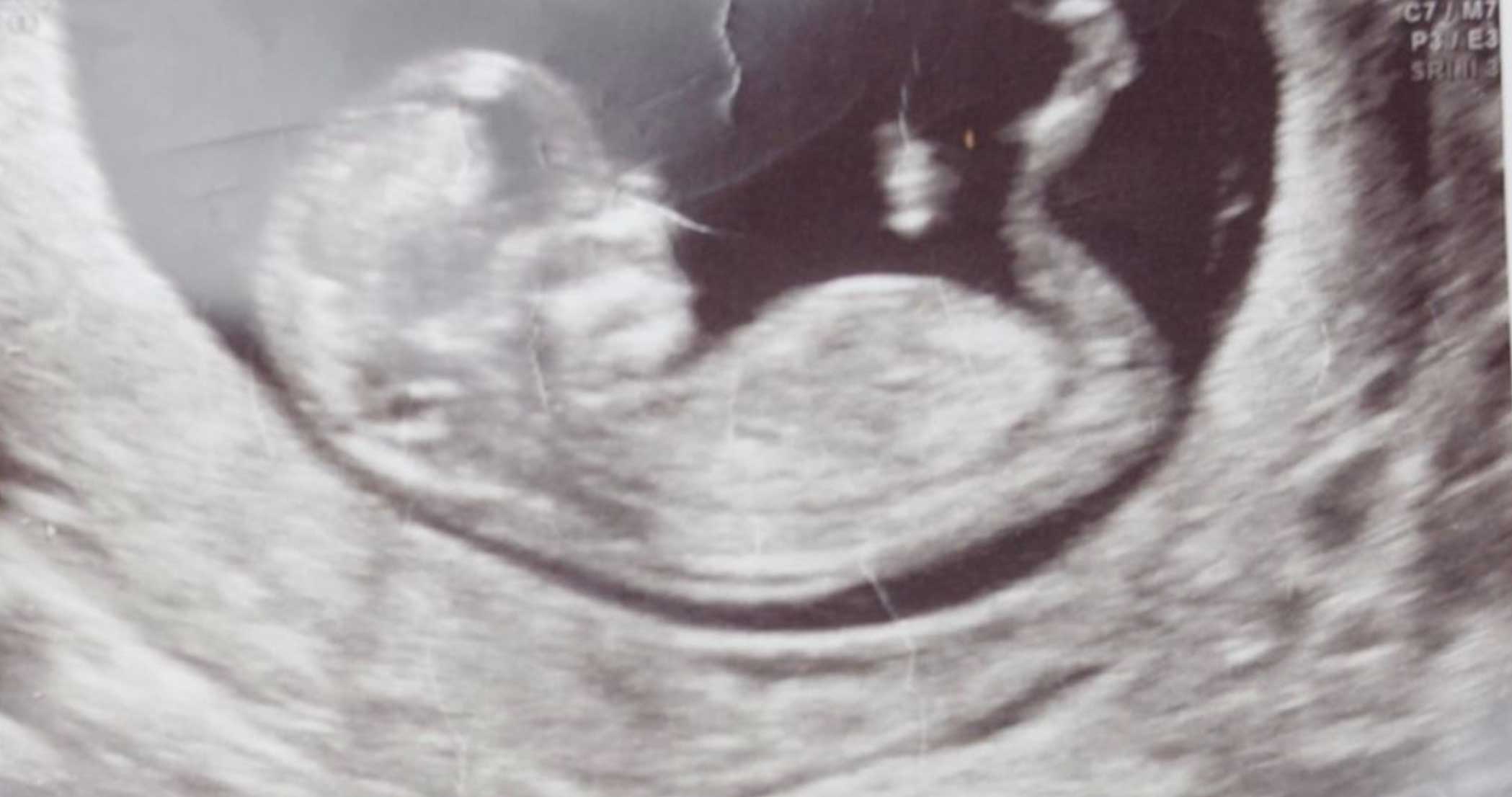 Female fertility testing in jordan